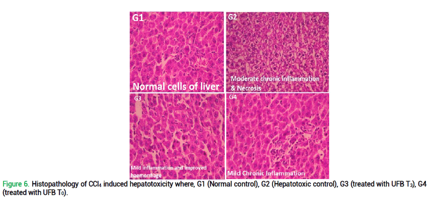 hepatotoxicity